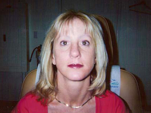 permanent cosmetic after 11